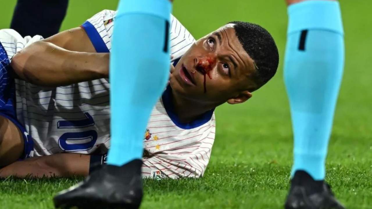astrogempak_euro-2024-patah-hidung-mbappe-disaran-pakai-topeng-ninja-turtle.jpg
