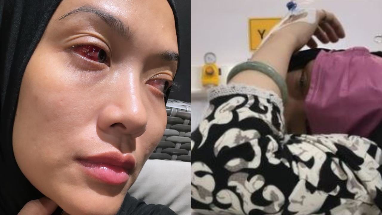 syatilla-melvin-muntah-muntah-mata-jadi-merah-ramai-doakan-cepat-sembuh.jpg
