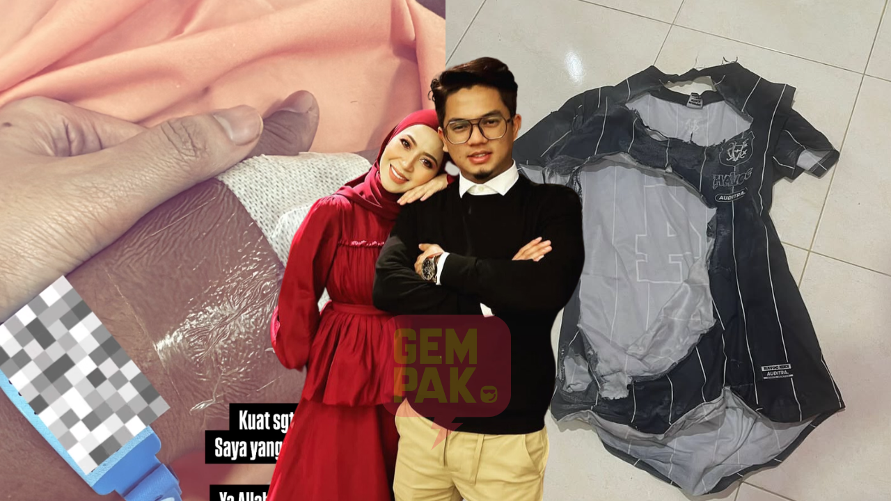 astro_gempak_suami-syura-badron-melecur-teruk-gas-masak-meletup.png