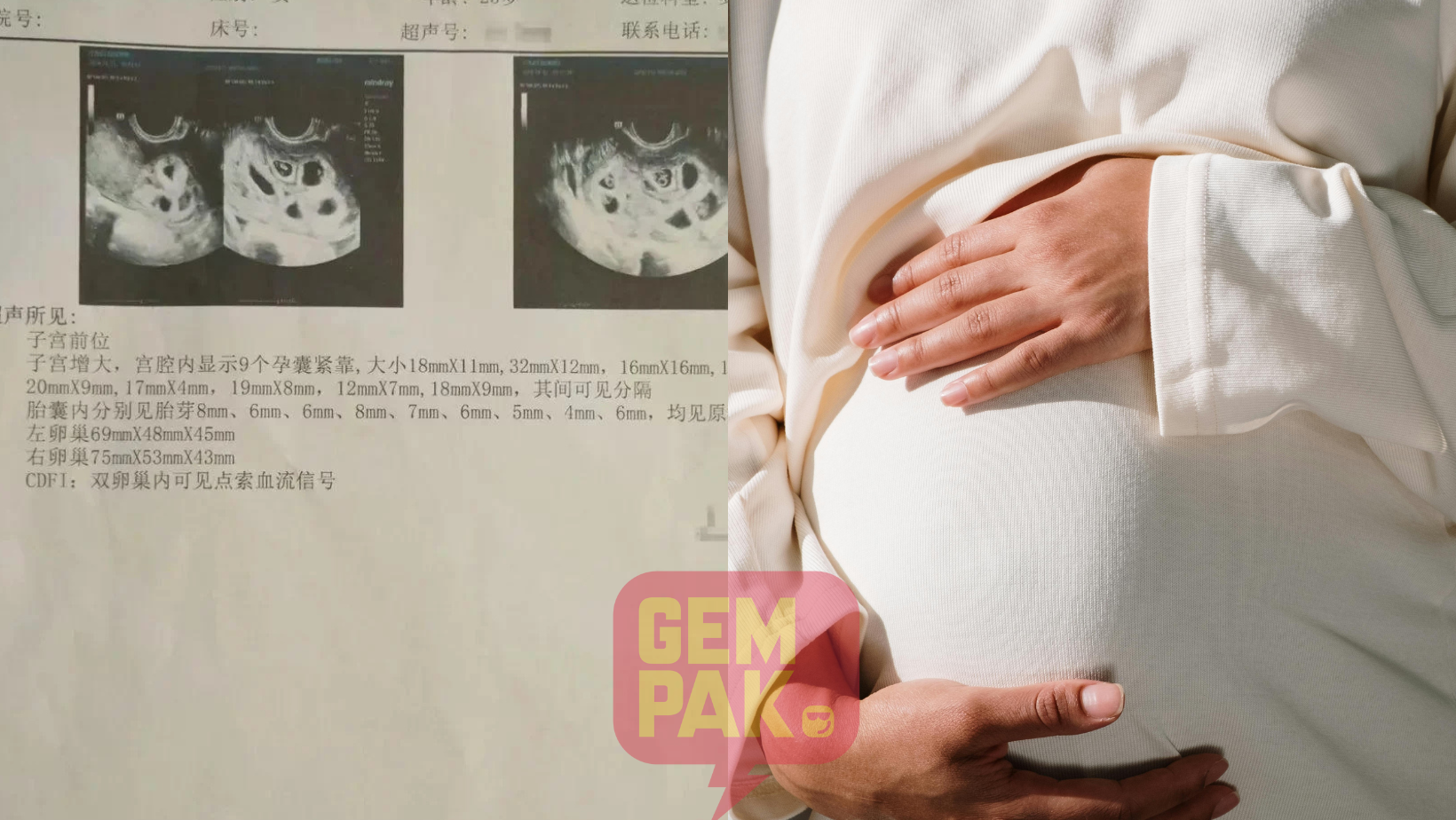 astrogempak_baby.png