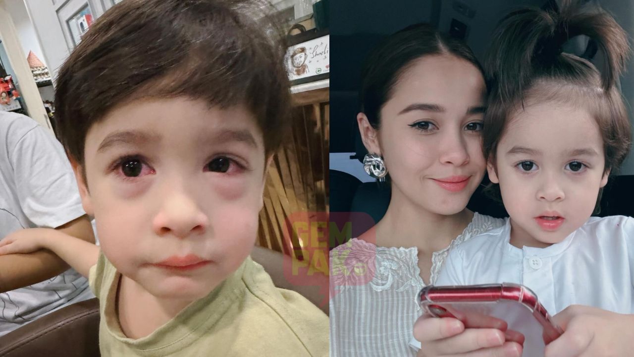 astro-gempak_anak_emma_alergic.jpg