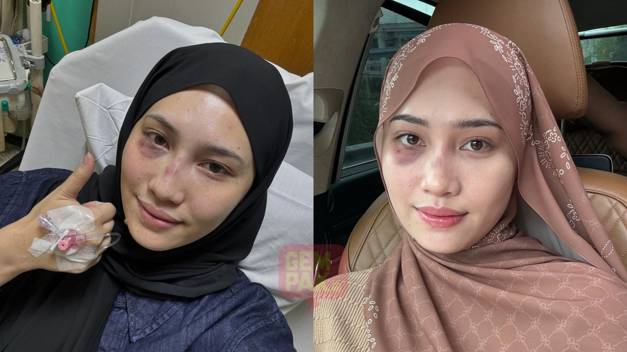 astro_gempak_influencer-didakwa-dipukul-suami-buka-cerita-sebenar.png
