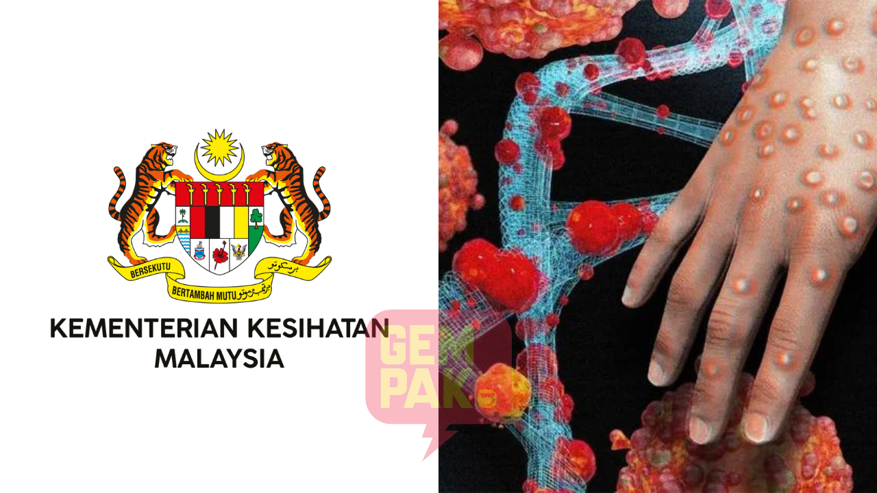 astro_gempak_kkm-kesan-satu-kes-mpox.png