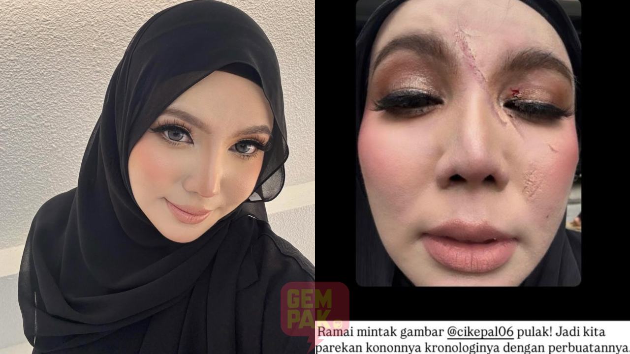 astro_gempak_penuh-kesan-cakaran-rakan-baik-kongsi-wajah-terbaharu-cik-epal-lepas-diserang.jpg