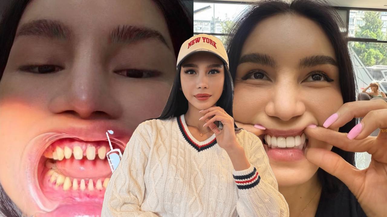 astro_gempak_nak-lawa-bukan-mudah-sajat-kongsi-perjalanan-cantikkan-gigi-kadang-nampak-sakit.jpg