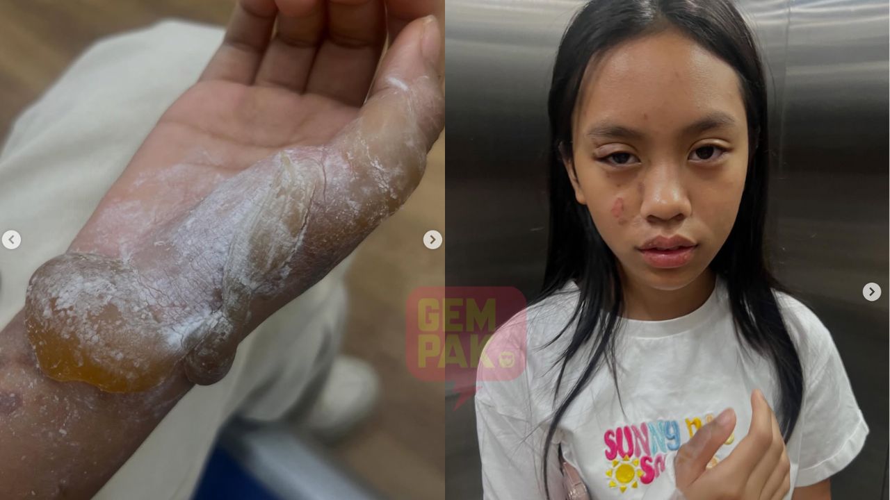 astrogempak_thalita_kena_minyak_panas.jpg