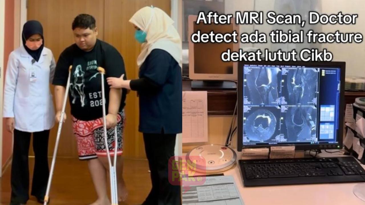 astro_gempak_cik-b-terkejut-alami-tibial-fracture-di-bahagian-lutut-kiri-ingatkan-jatuh-biasa.jpg