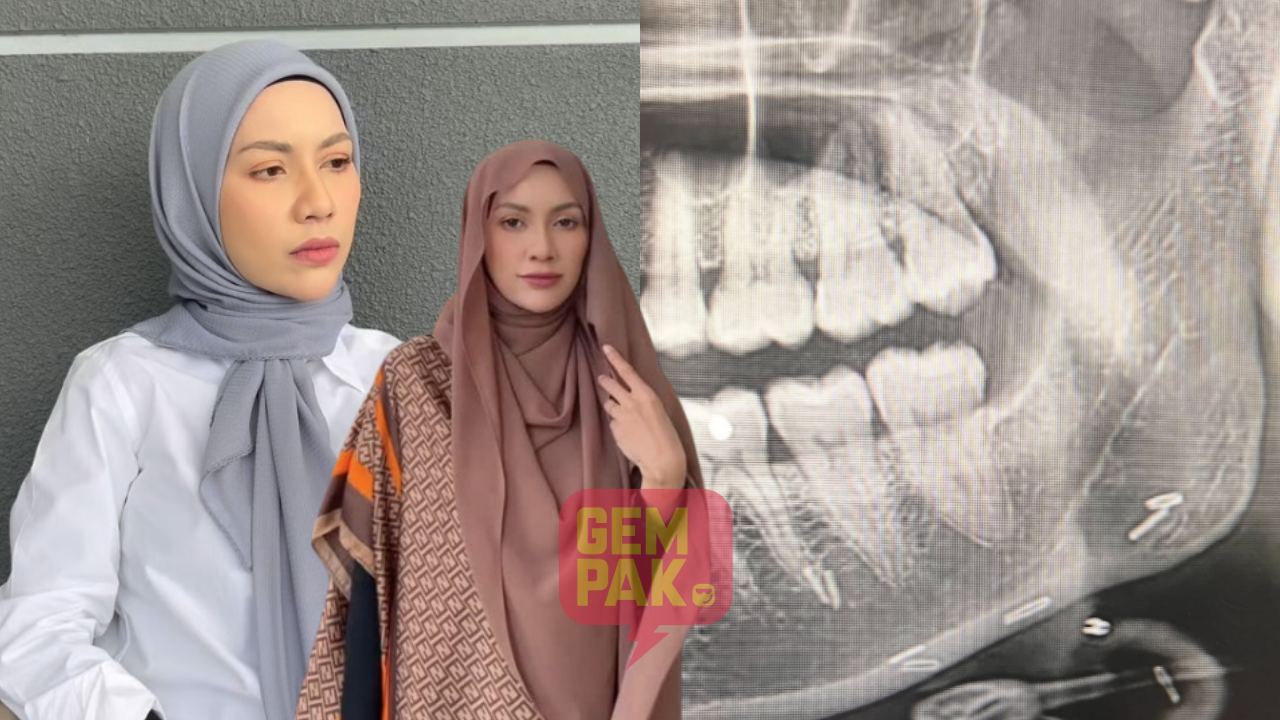 astrogempak_zara_pakai_susuk.png