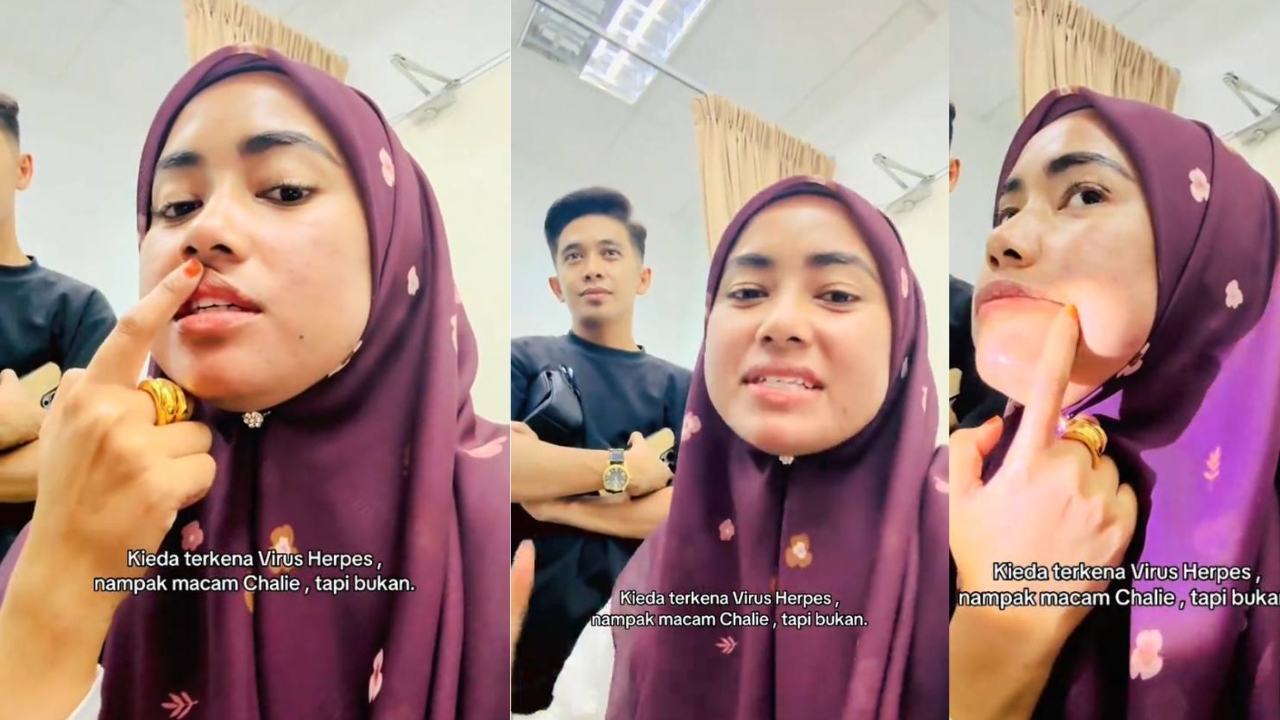 astro_gempak_kieda_herpes.jpg