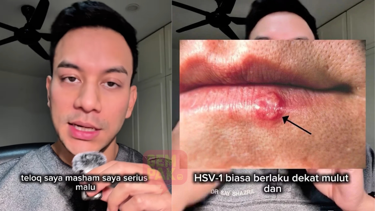 astro_gempak_say_herpes.jpg