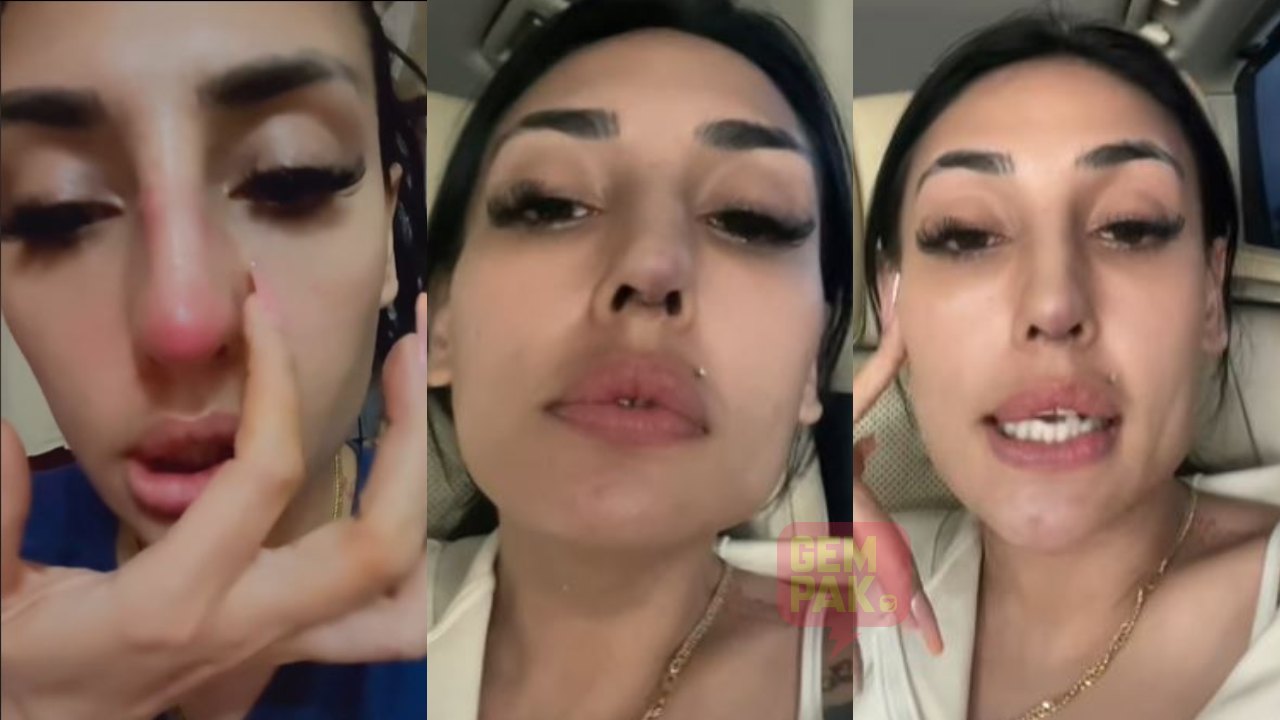 astro_gempak_zarina-anjoulie-menyesal-buat-hidung-kena-jangkitan-teruk-hingga-bernanah.jpg