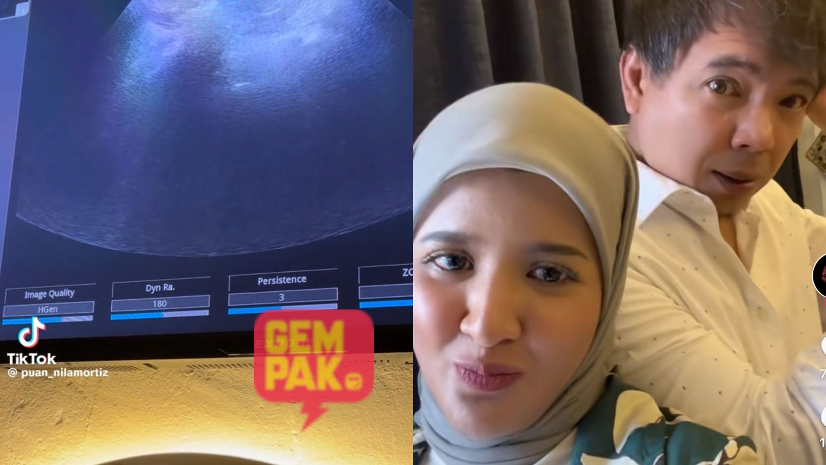 astrogempak_isteri_azlan_hamil.png