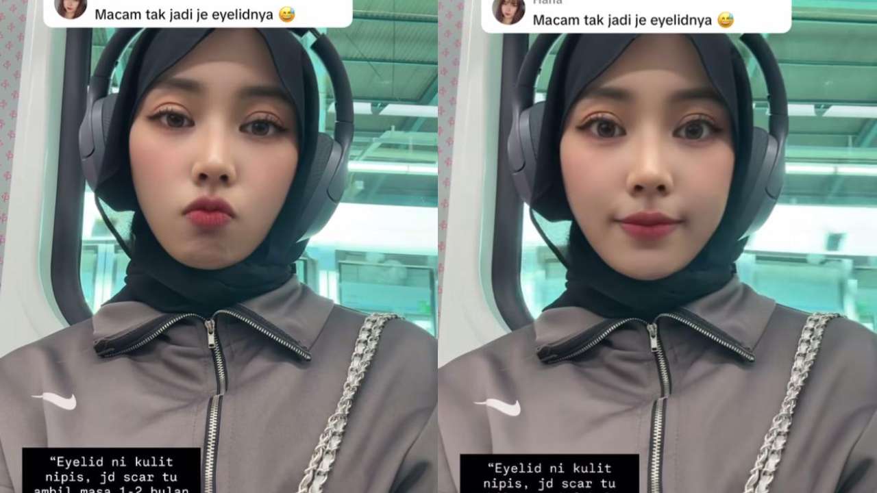 Kim Seri jawab kelopak mata