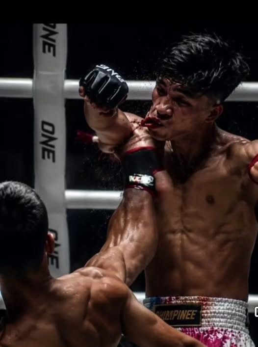 Doakan kesembuhan petarung muay thai negara, selamat jalani pembedahan ...