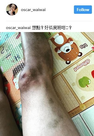 oscar_leg_03.jpg oscar_leg_03.jpg