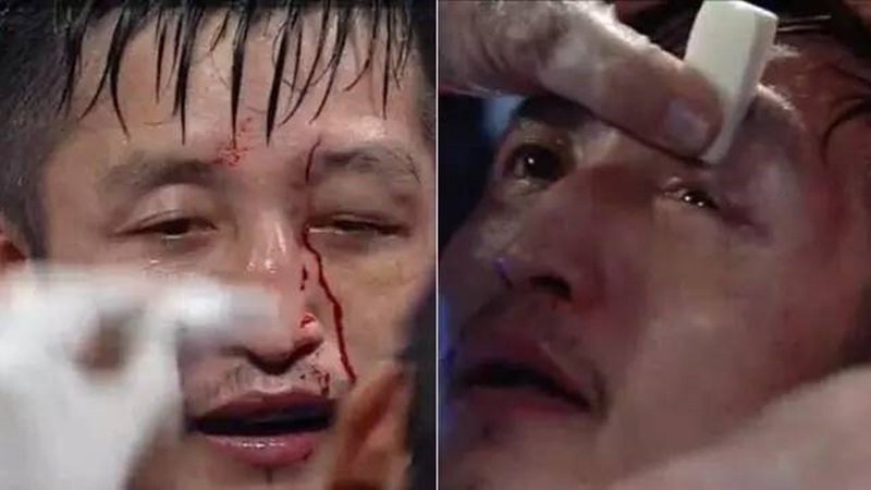 eye_06.jpg eye_06.jpg