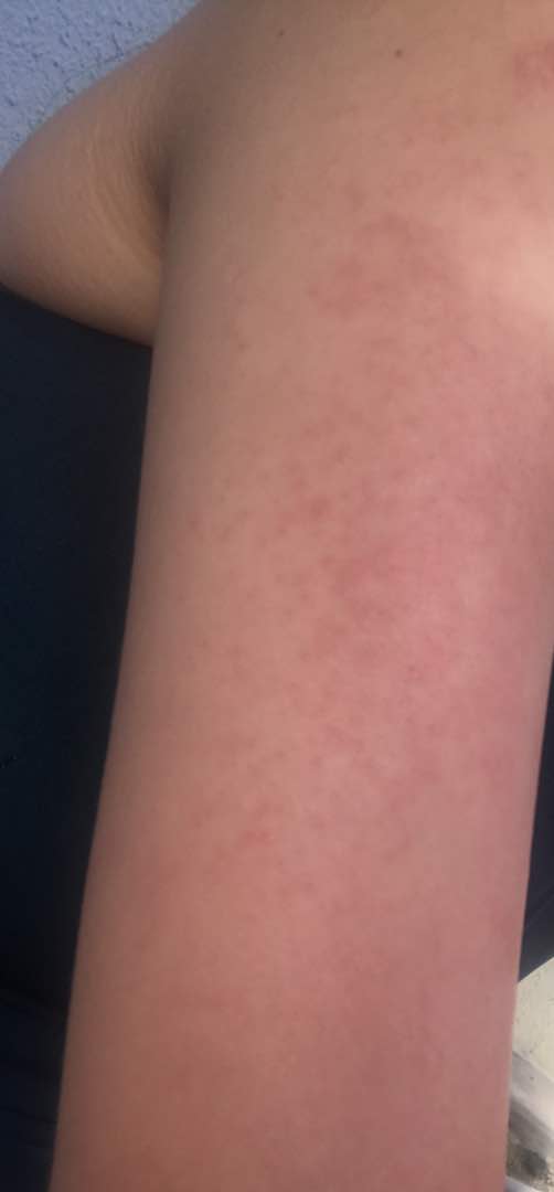 19620070_10154792338833511_337127175_o.jpg 19620070_10154792338833511_337127175_o.jpg