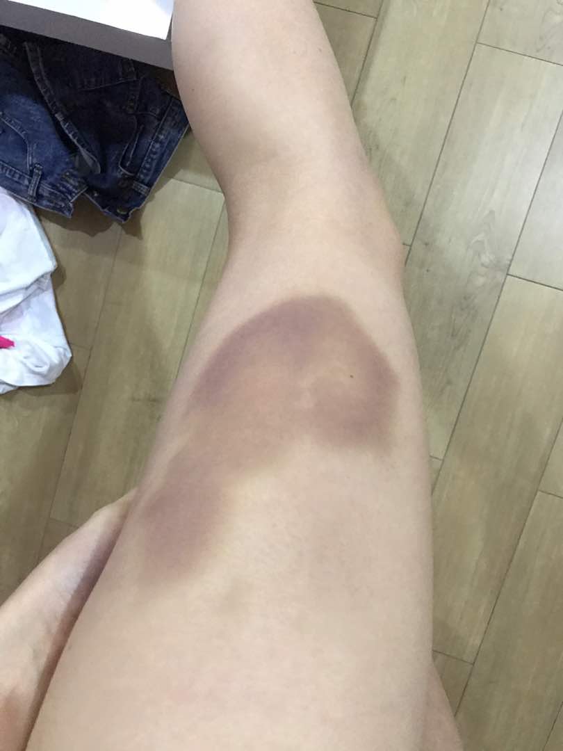 19648051_10154792339058511_327783846_o.jpg 19648051_10154792339058511_327783846_o.jpg