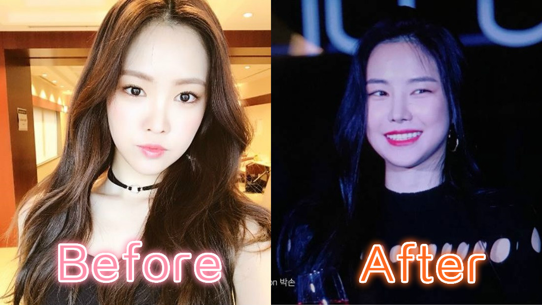 compare_meitu_2.jpg compare_meitu_2.jpg