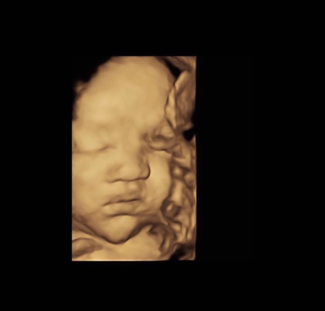 640_74a75dfe5f33b4b63f36a8781addb4a0.jpg 640_74a75dfe5f33b4b63f36a8781addb4a0.jpg