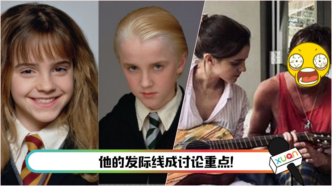 harry.png