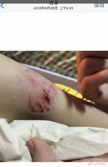 b9ba54cbgy1ga6wmkxc2dj20d20k5gtb.jpg b9ba54cbgy1ga6wmkxc2dj20d20k5gtb.jpg