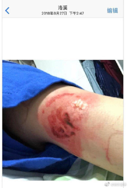 b9ba54cbgy1ga6wmkv6p7j20ca0i045p.jpg b9ba54cbgy1ga6wmkv6p7j20ca0i045p.jpg