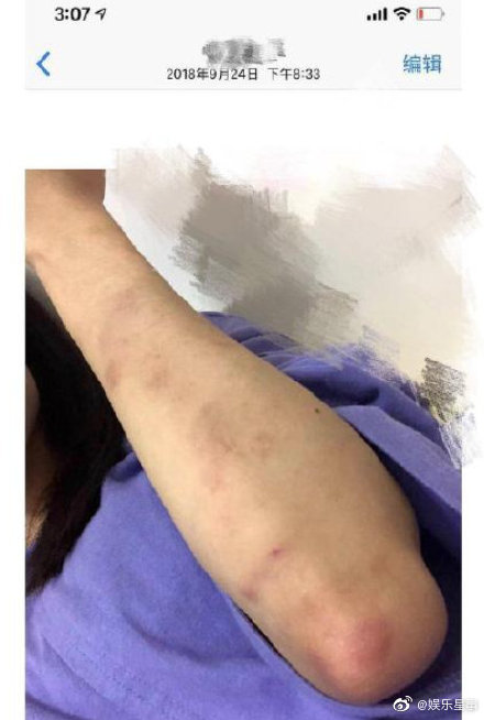 b9ba54cbgy1ga6wmkv82jj20cv0j4tgo.jpg b9ba54cbgy1ga6wmkv82jj20cv0j4tgo.jpg