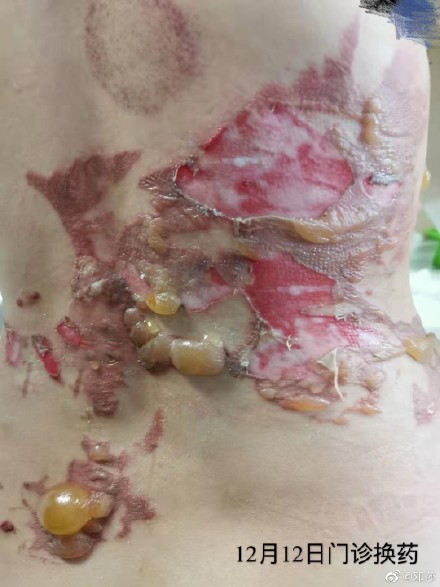 637686a1ly1g9w0ray0wuj20u014045r.jpg 637686a1ly1g9w0ray0wuj20u014045r.jpg