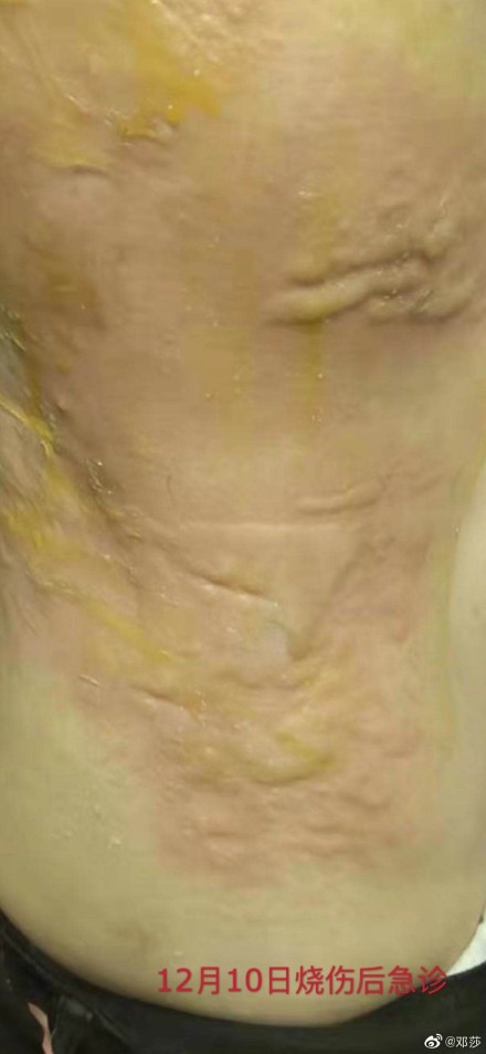 637686a1ly1g9w19x3r3xj20n31e0n2r-(1).jpg 637686a1ly1g9w19x3r3xj20n31e0n2r-(1).jpg