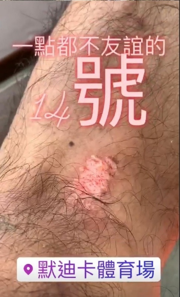 li1-(1).jpg li1-(1).jpg