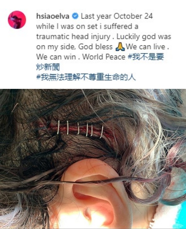 elva_03.jpg elva_03.jpg