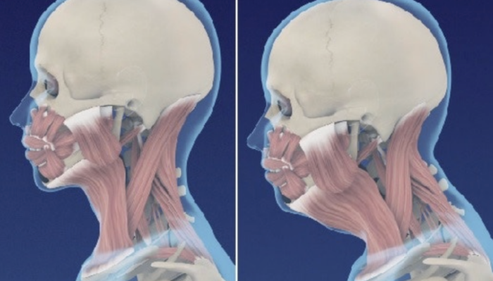 cause-of-double-chin.png cause-of-double-chin.png