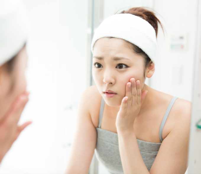 pimple-trigger.png