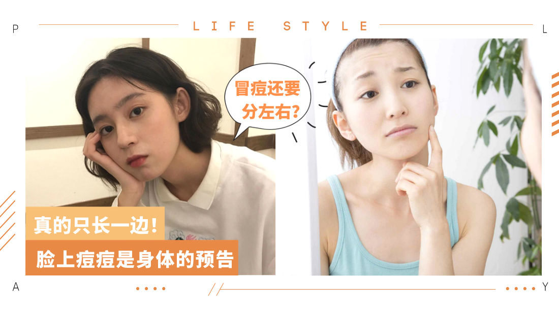 pimple-prob.png