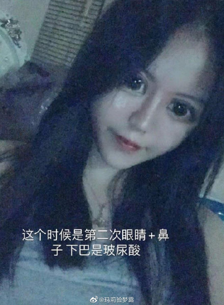 007Bb1W0ly1gc9xxpjdrsj30r010ux6p.jpg 007Bb1W0ly1gc9xxpjdrsj30r010ux6p.jpg