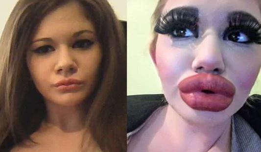 Andrea-Ivanova-Bulgaria-wasted-face-in-becoming-Barbie-doll-ni24news.jpg Andrea-Ivanova-Bulgaria-wasted-face-in-becoming-Barbie-doll-ni24news.jpg