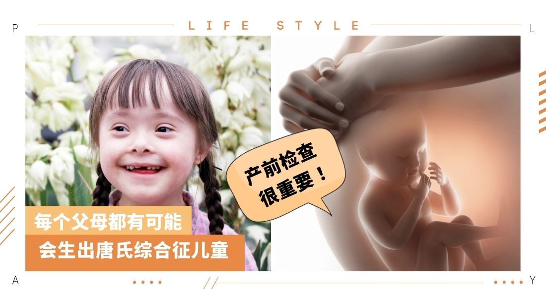 down-syndrome.jpg