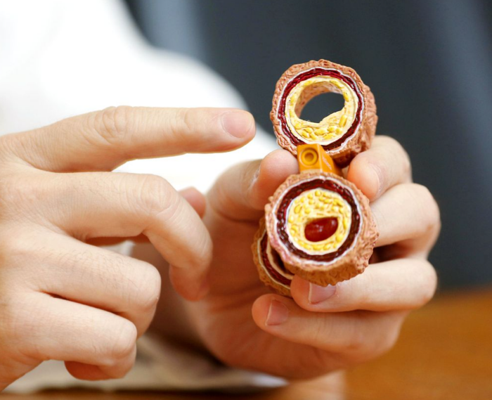 blood-cord.png blood-cord.png