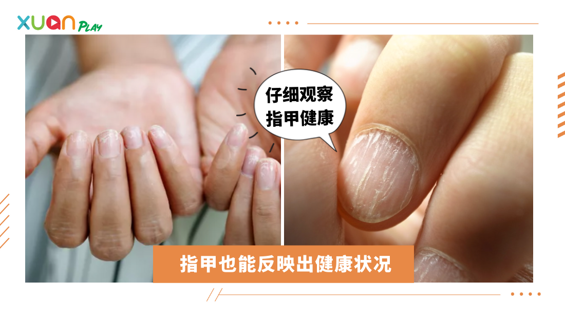 nails-show-healthy.png