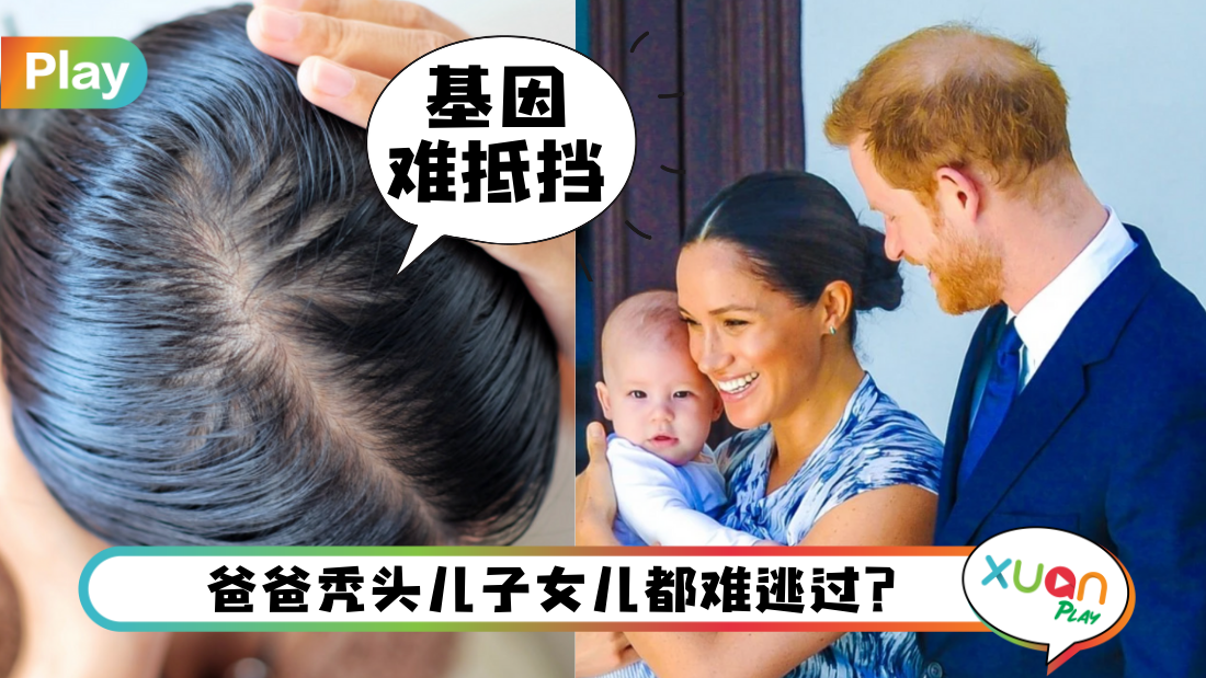 hair-fall.png