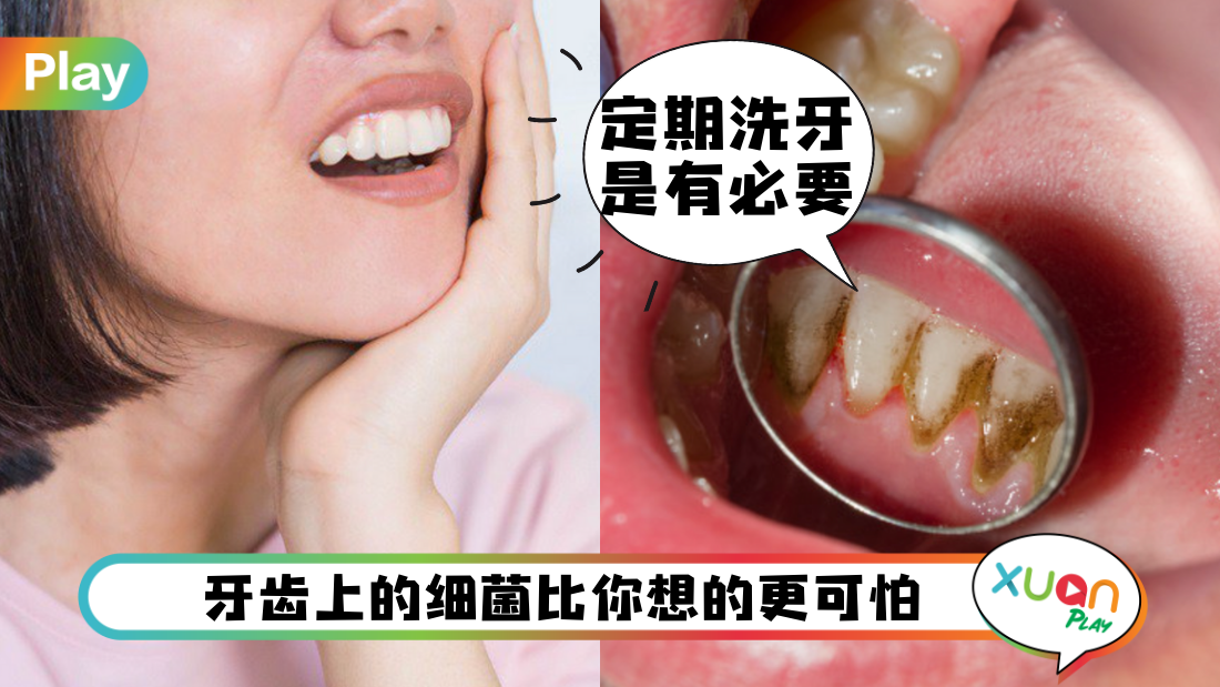teeth.png