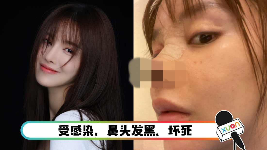 bizizhengrong_cover.png