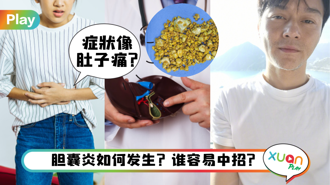 gallbladder.png
