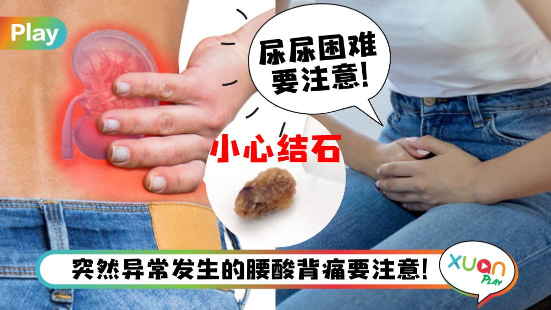 kidney-stone.jpg