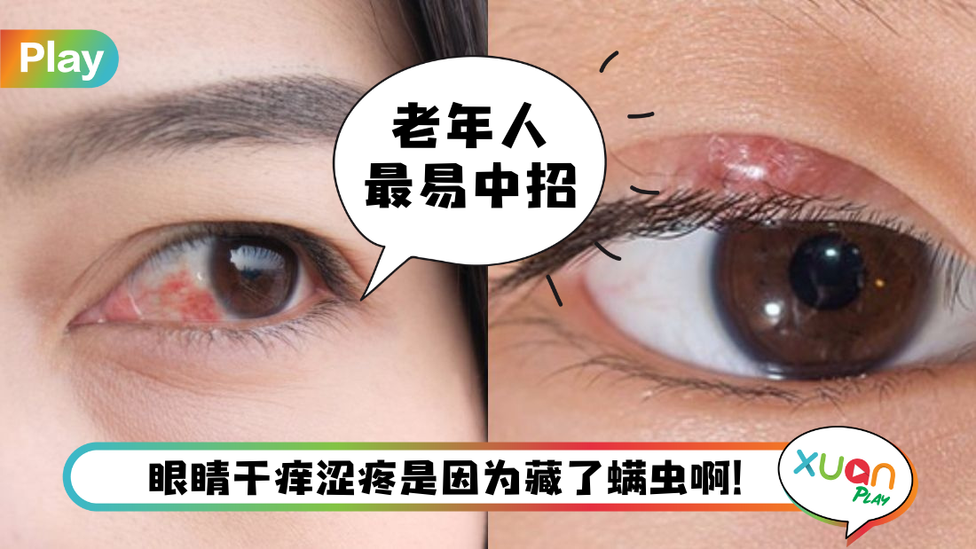 eye-dry.png