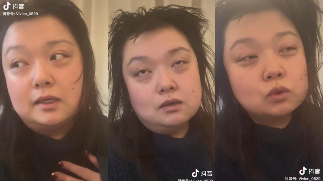 细细粒确诊三天不洗头