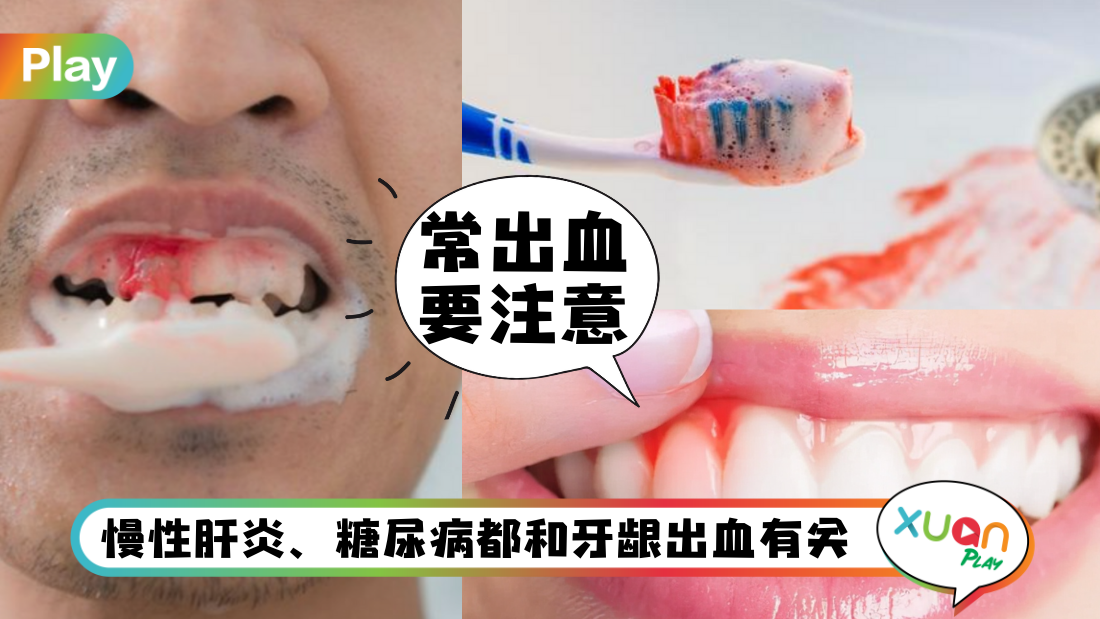 gum.png