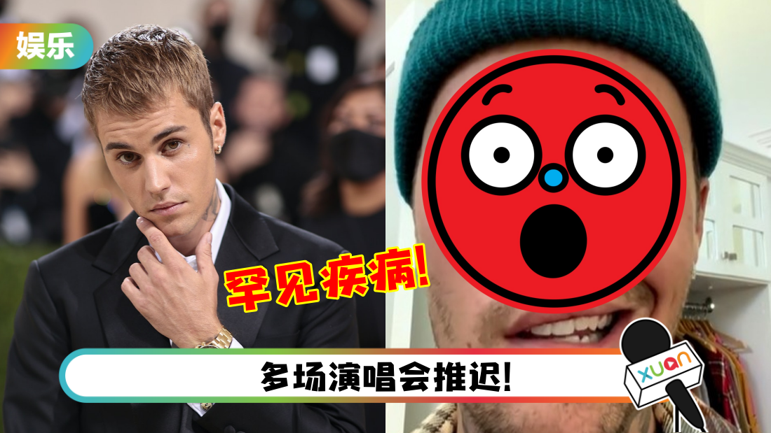 biber_title.png