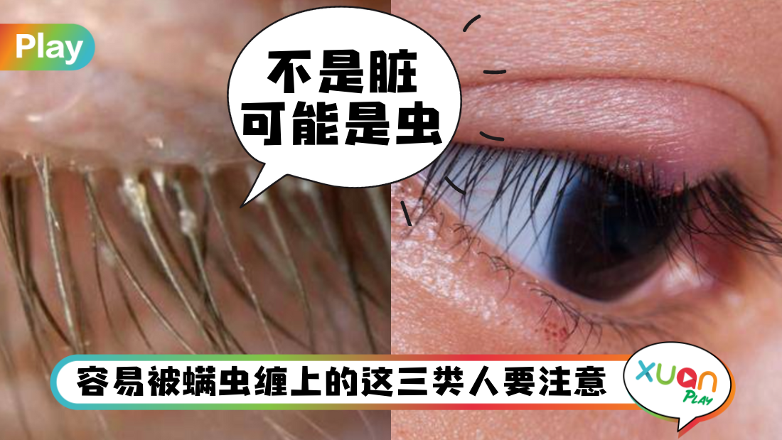 eye-bug.png